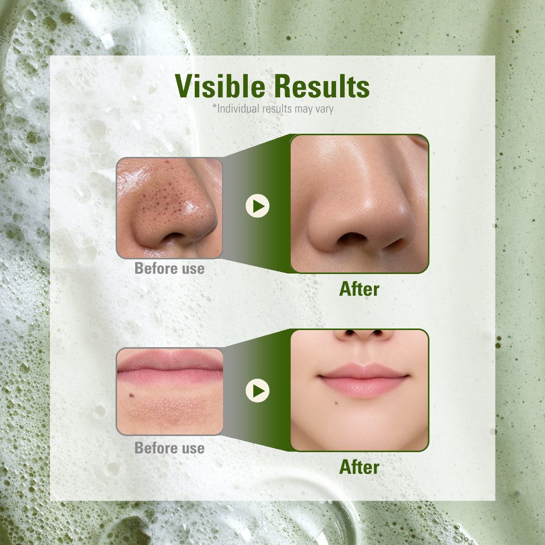 [Amazon’s Choice] Herbal Mucin Soap Bar
