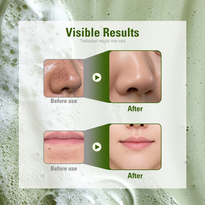 [Amazon’s Choice] Herbal Mucin Soap Bar