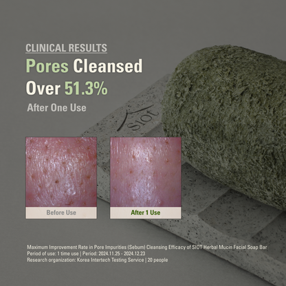 [Amazon’s Choice] Herbal Mucin Soap Bar